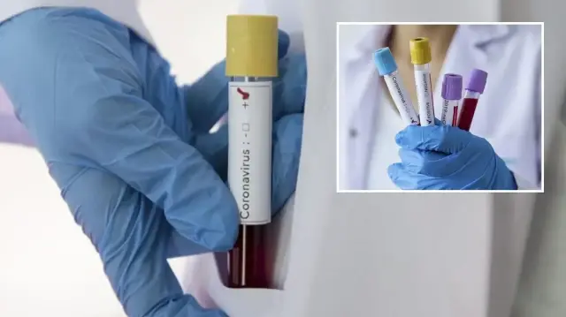 zayiflar kovid 19u daha agir geciriyor sUS3OE4C.webp